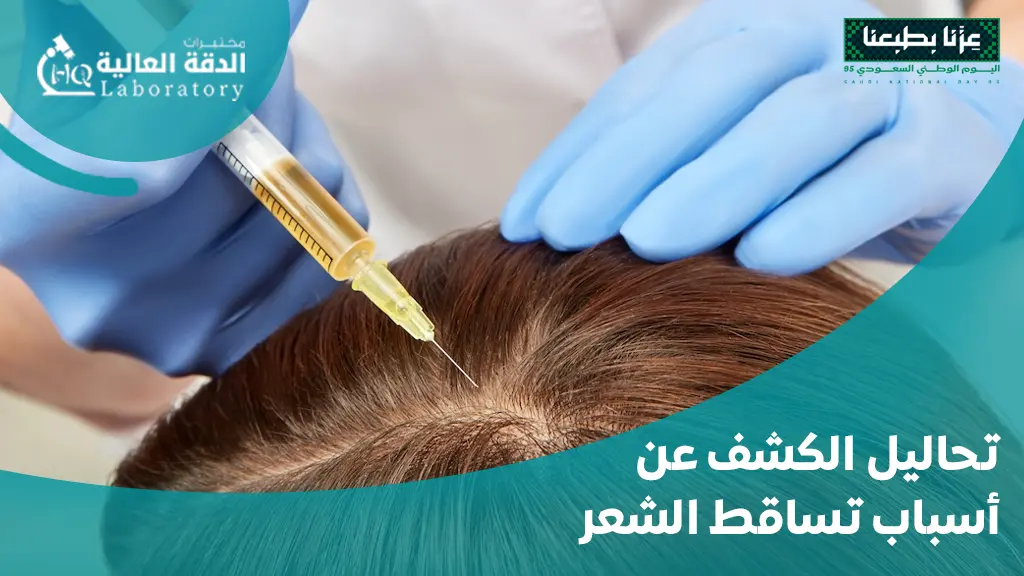 اسعار تحاليل تساقط الشعر