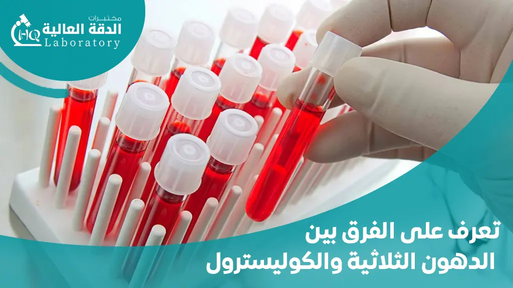الفرق بين الدهون الثلاثية والكوليسترول