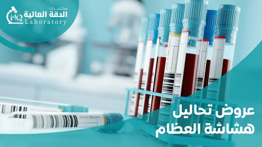 عروض تحاليل شاملة جدة