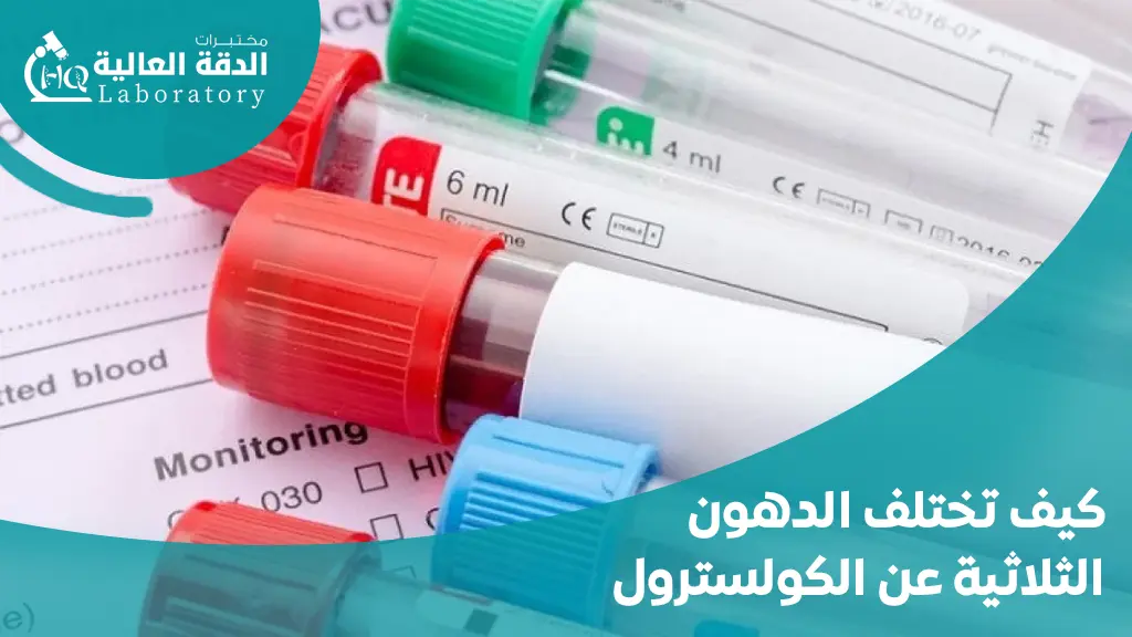 الفرق بين الدهون الثلاثية والكوليسترول