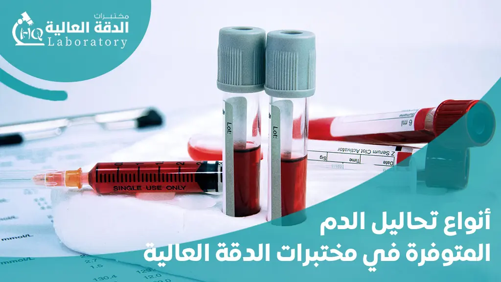 سعر تحليل الدم الشامل في السعودية