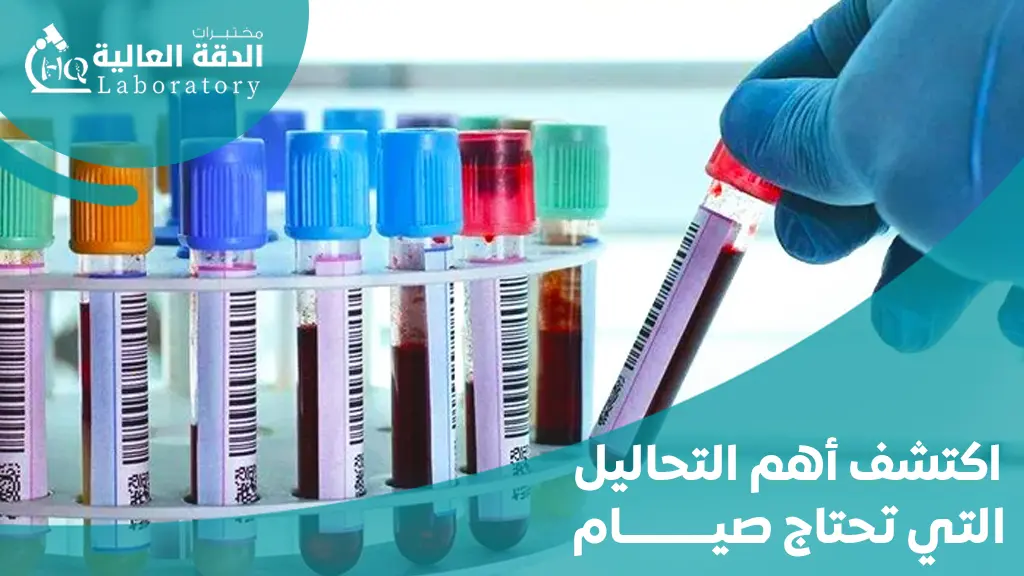 التحاليل التي تحتاج صيام