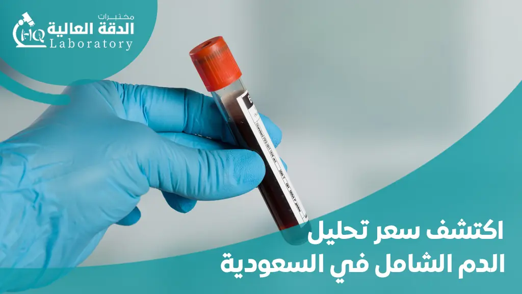 سعر تحليل الدم الشامل في السعودية