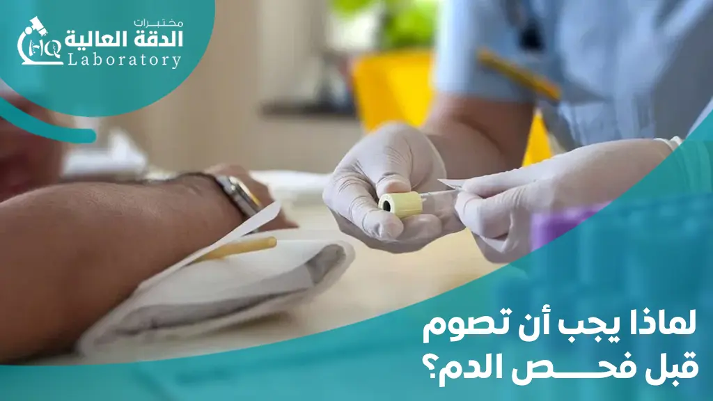 التحاليل التي تحتاج صيام