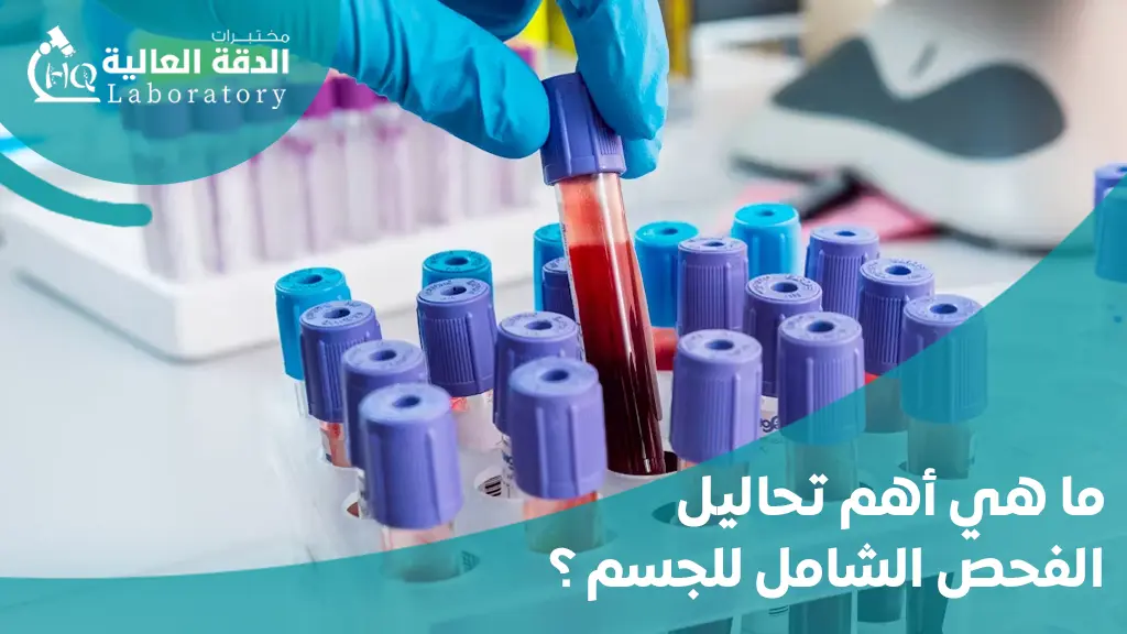 سعر تحليل الدم الشامل في السعودية