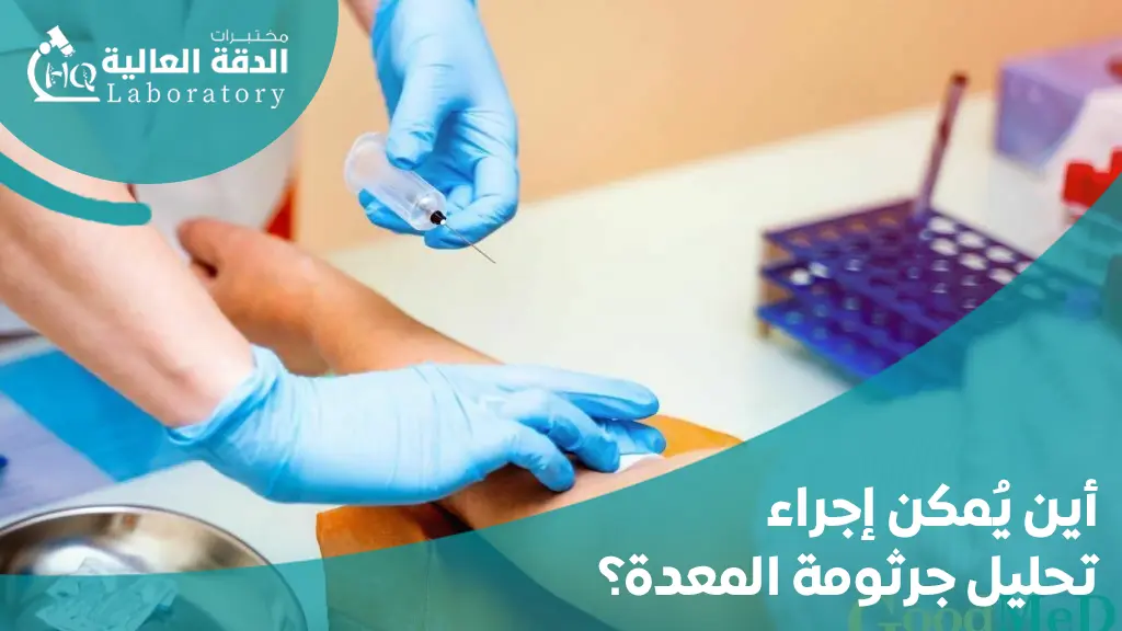 افضل تحليل لجرثومة المعده