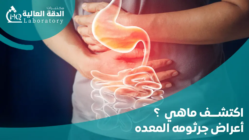 ما الفرق بين تحليل جرثومة المعدة في الدم و البراز؟