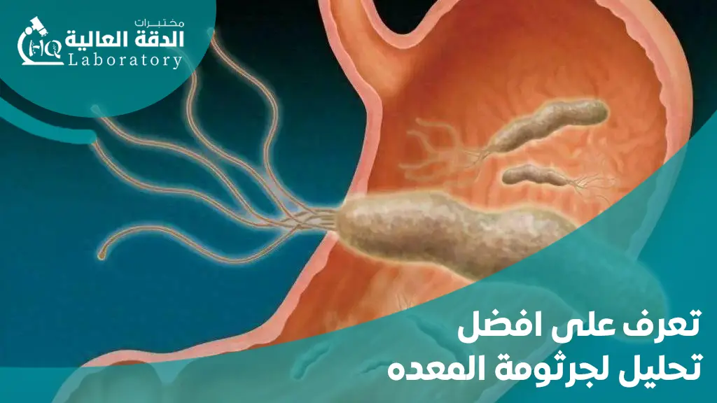 افضل تحليل لجرثومة المعده