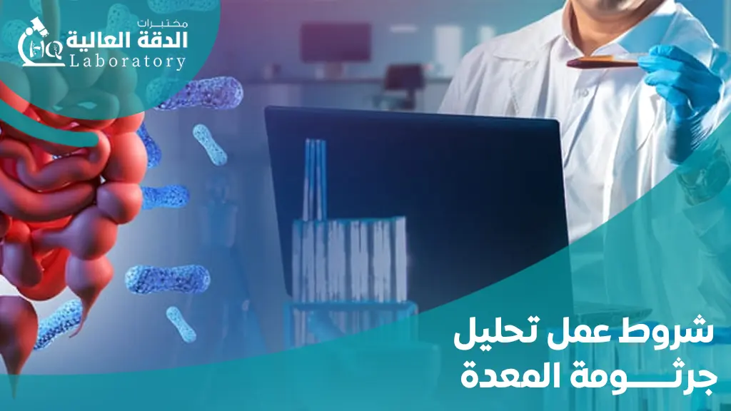 افضل تحليل لجرثومة المعده