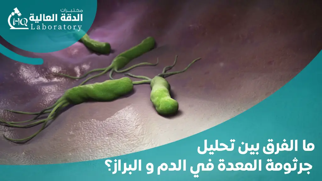ما الفرق بين تحليل جرثومة المعدة في الدم و البراز؟