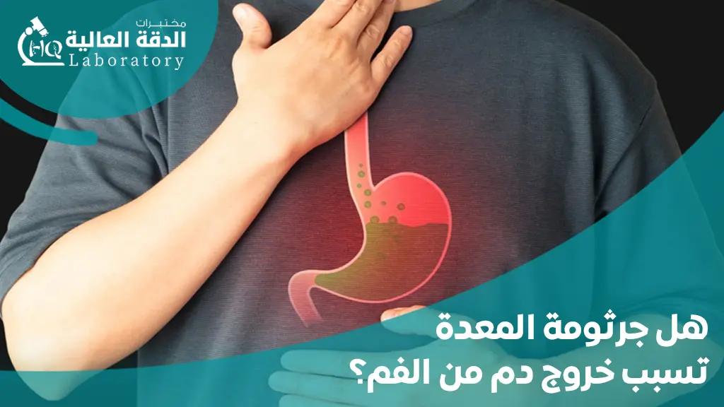 ما الفرق بين تحليل جرثومة المعدة في الدم و البراز؟