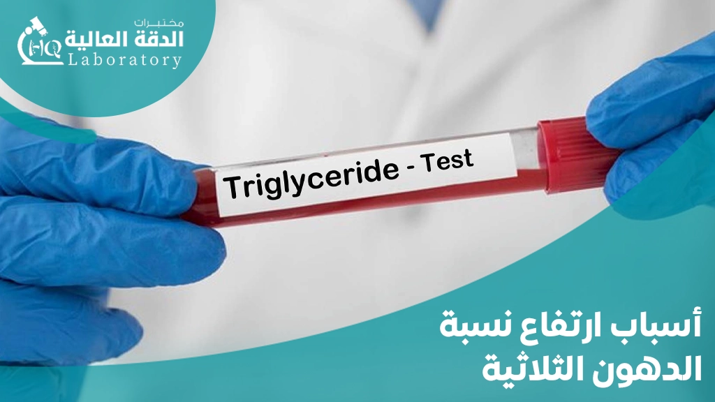 اعراض الكولسترول والدهون الثلاثيه