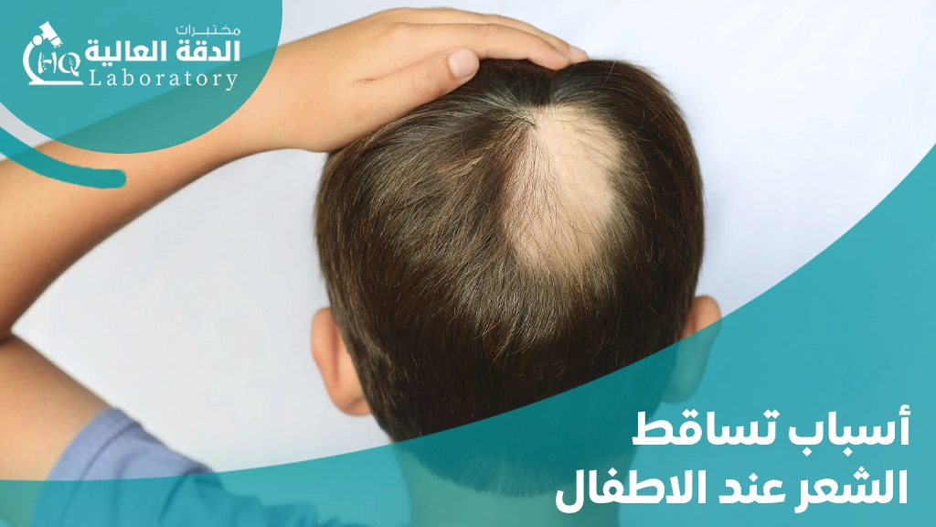 اهم تحاليل تساقط الشعر