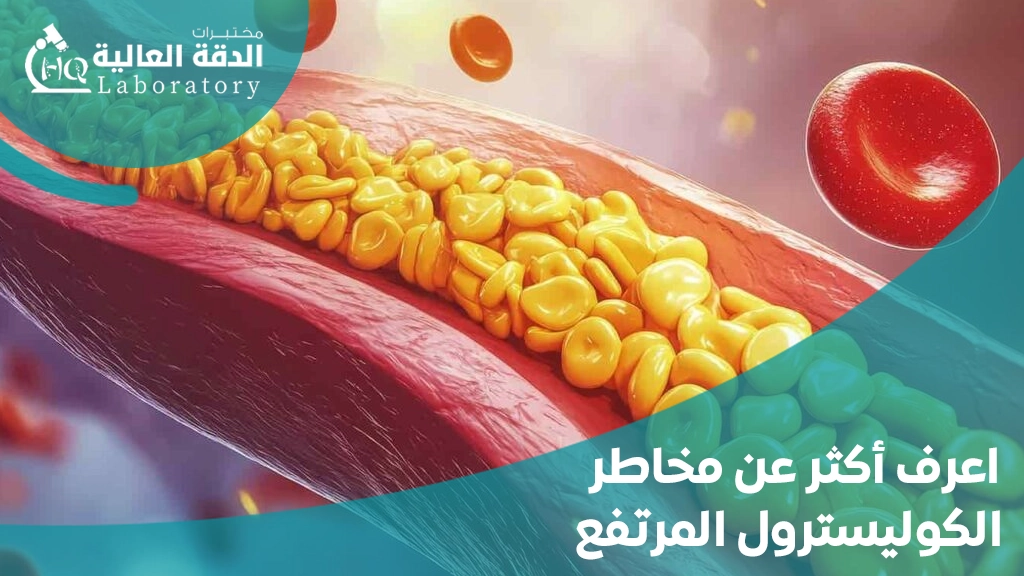 مخاطر الكوليسترول المرتفع