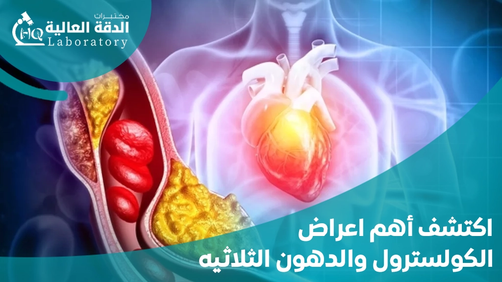 اعراض الكولسترول والدهون الثلاثيه