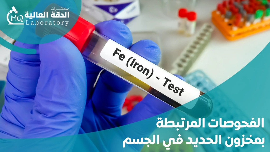 اعراض نقص مخزون الحديد في الدم