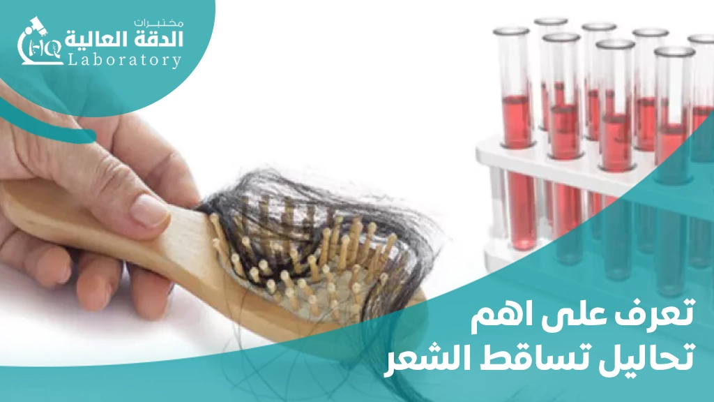 اهم تحاليل تساقط الشعر