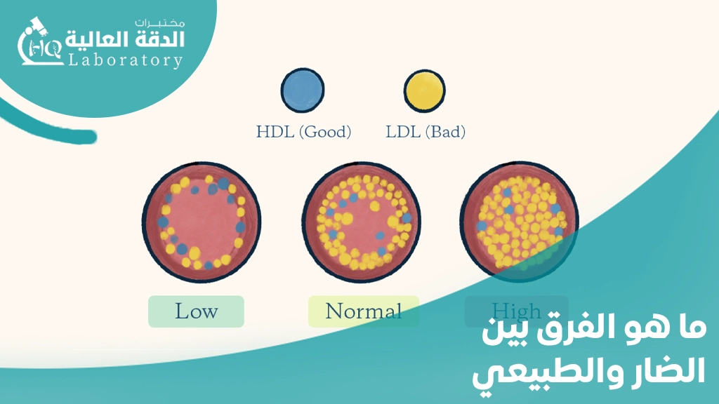 اعراض الكولسترول والدهون الثلاثيه
