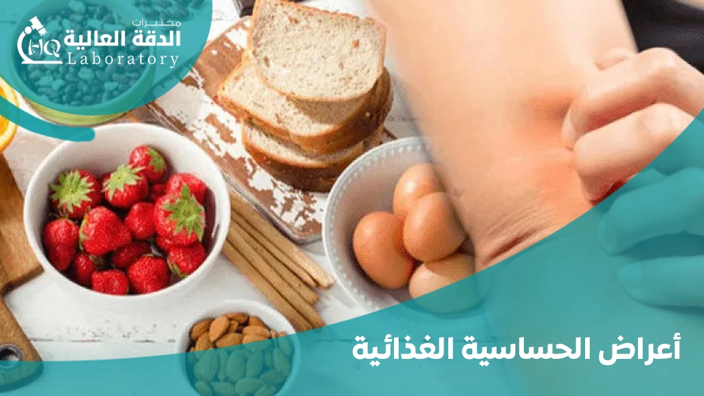 مسببات الحساسية الغذائية