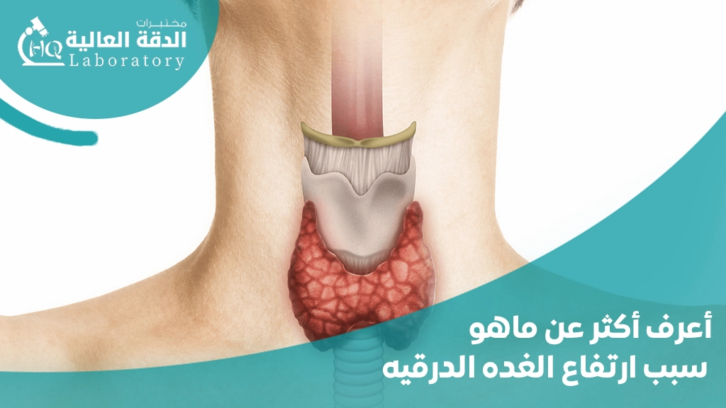 ماهو سبب ارتفاع الغده الدرقيه