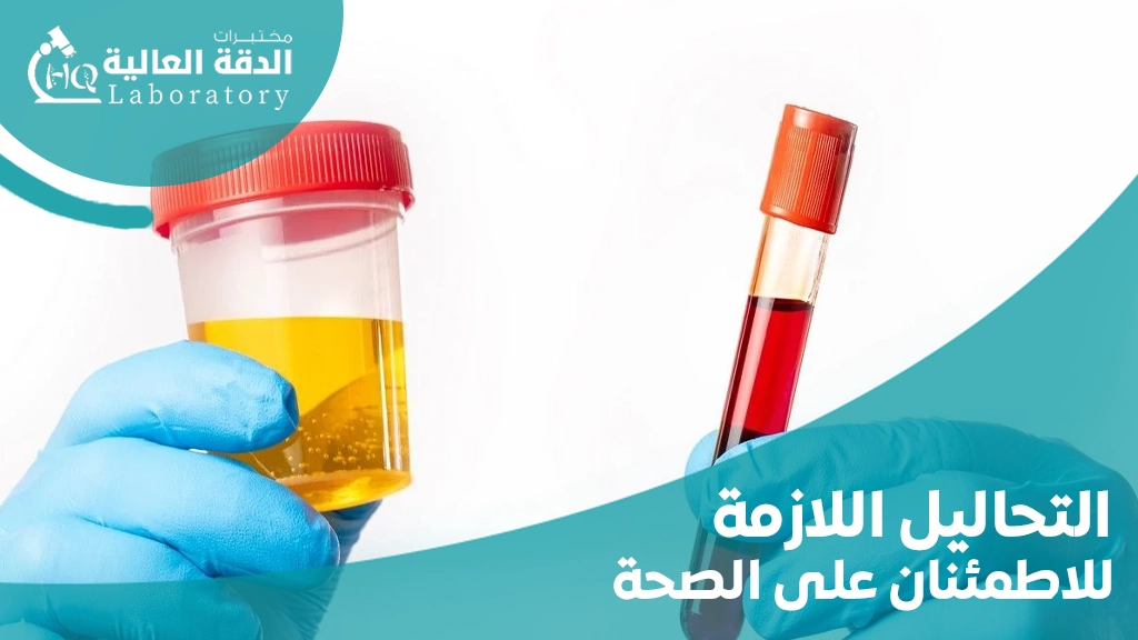 التحاليل اللازمة للاطمئنان على الصحة