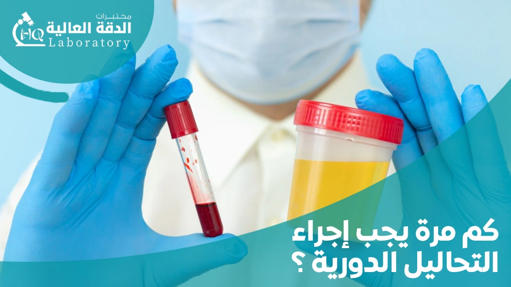 التحاليل اللازمة للاطمئنان على الصحة