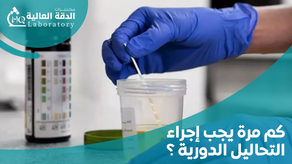 التحاليل اللازمة للاطمئنان على الصحة