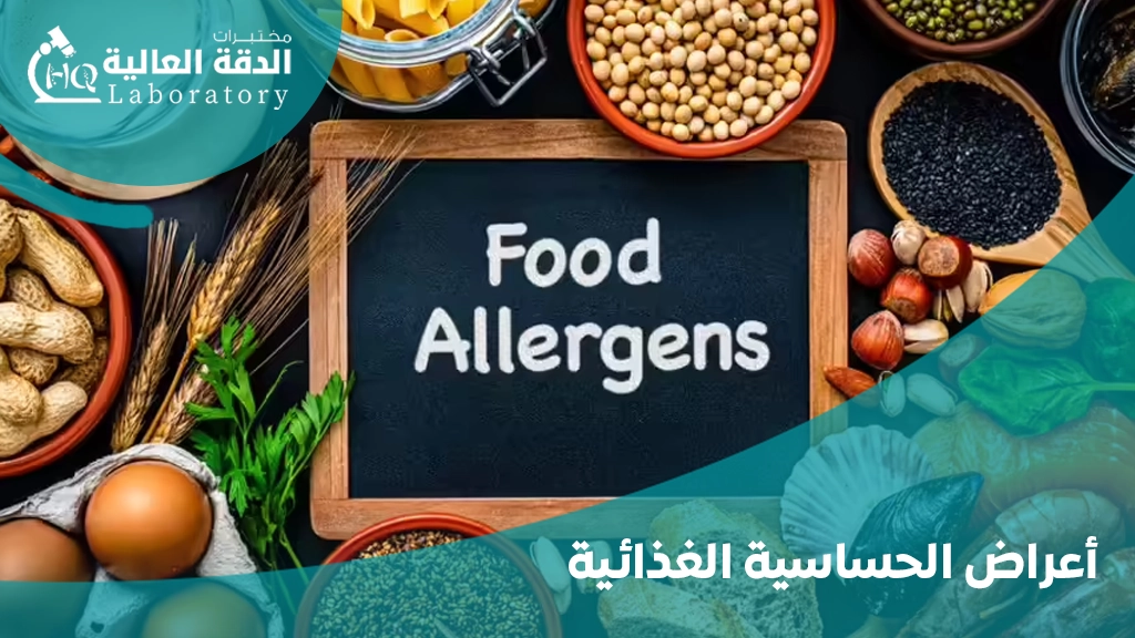 مسببات الحساسية الغذائية