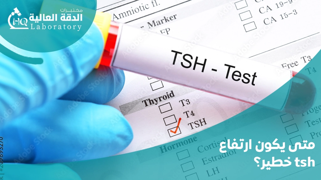 ماهو سبب ارتفاع الغده الدرقيه