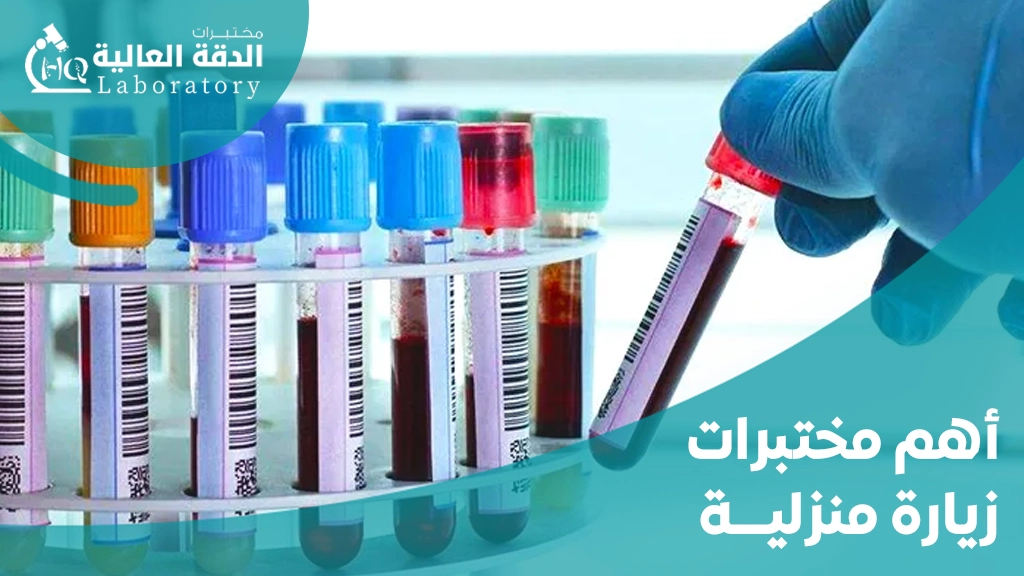 مختبرات زيارة منزلية