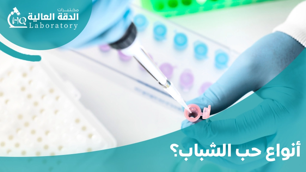 التحاليل اللازمة لحب الشباب