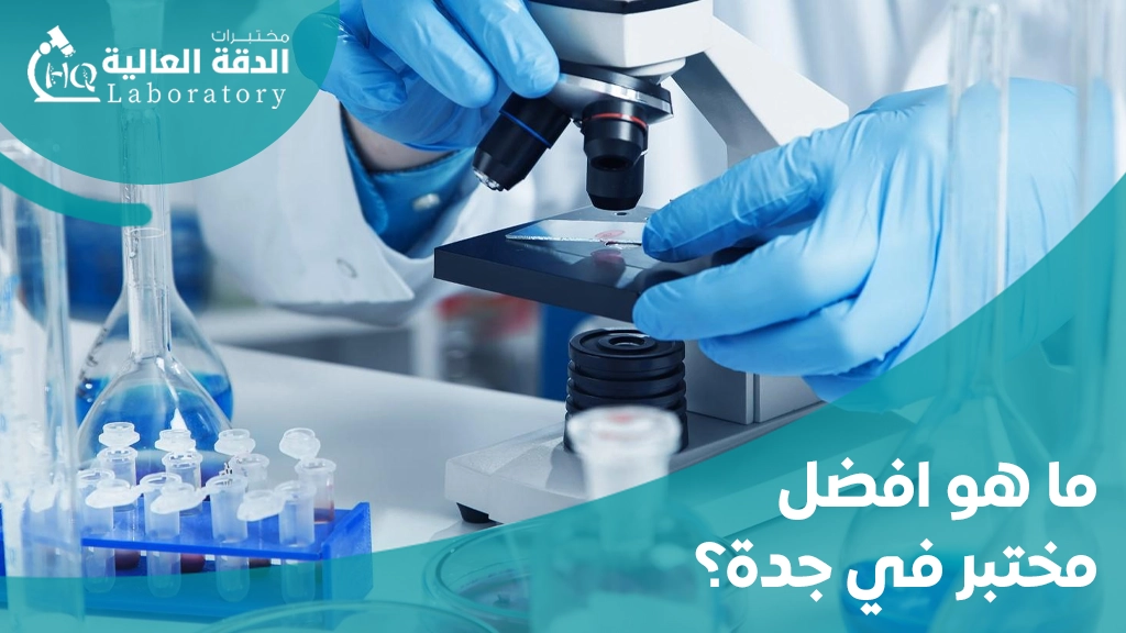 افضل المختبرات الطبية في جدة