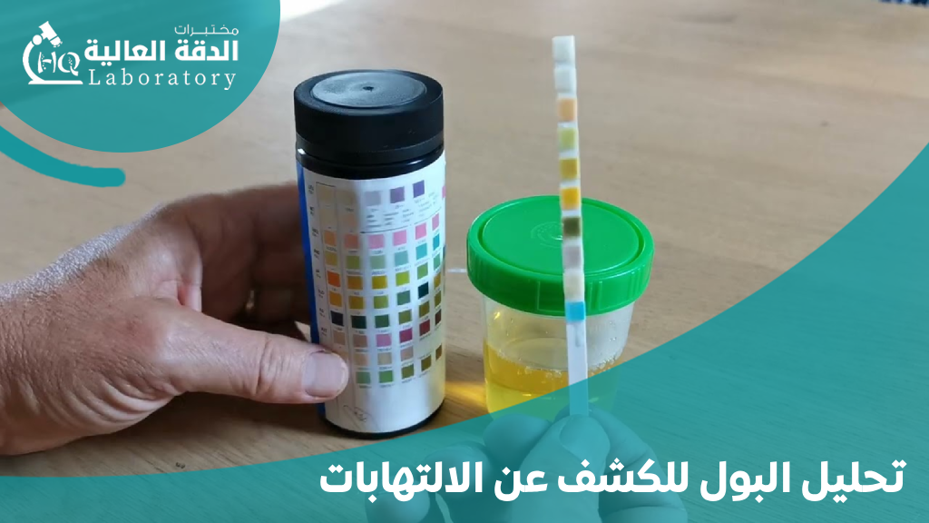 تحاليل الحمل في الشهر الاول