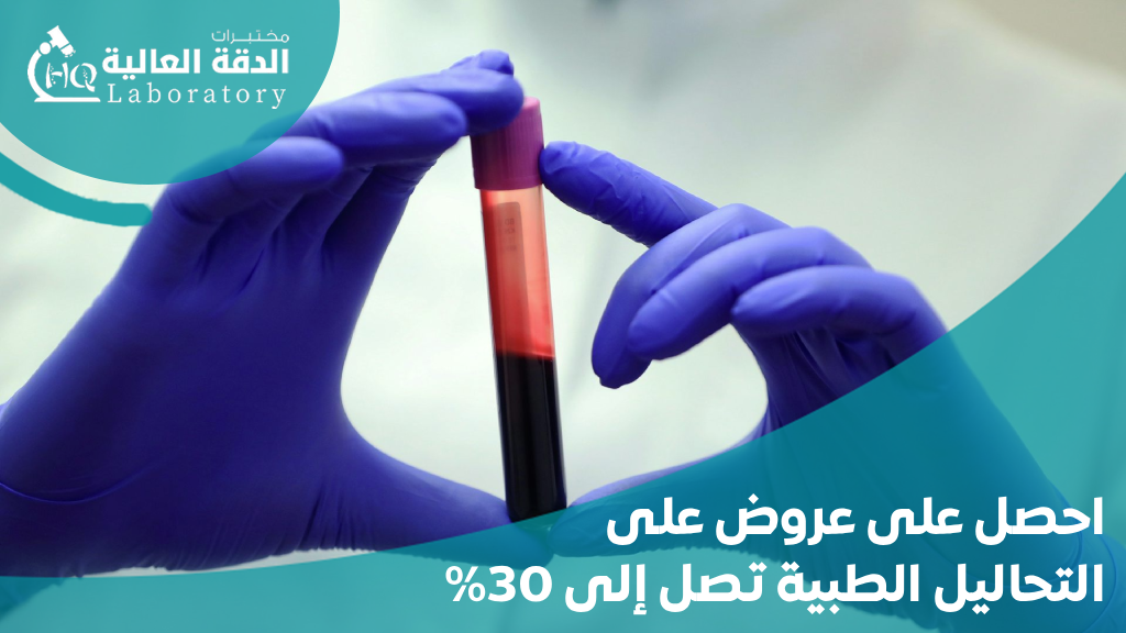 عروض على التحاليل الطبية