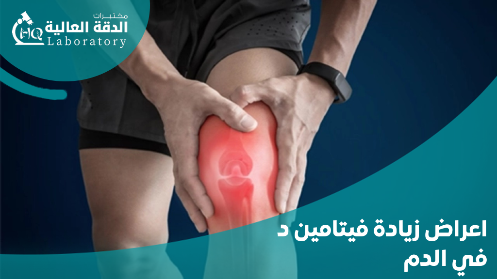 اسعار تحليل فيتامين د