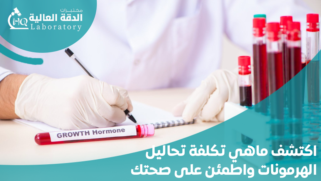 تكلفة تحاليل الهرمونات