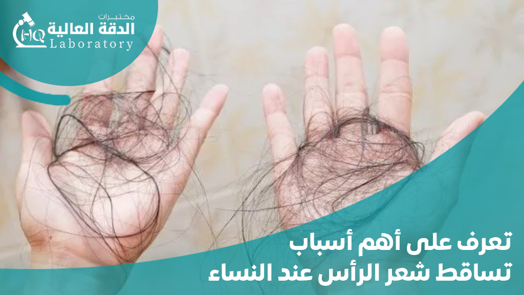 أسباب تساقط شعر الرأس عند النساء