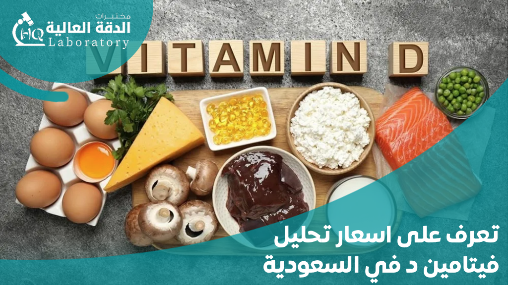 اسعار تحليل فيتامين د