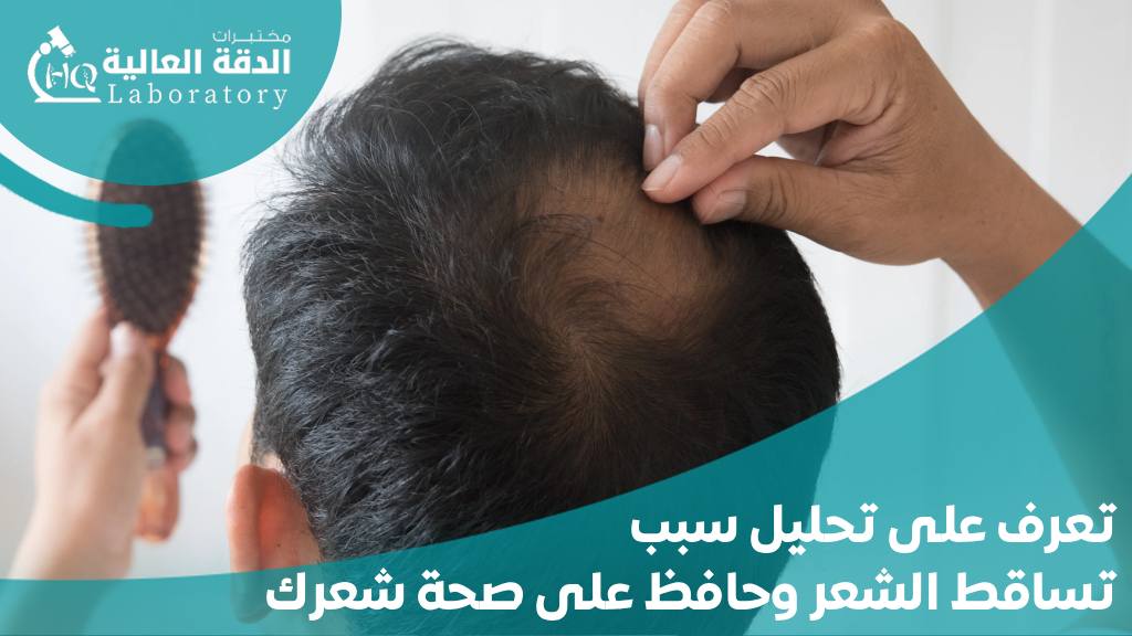 تحليل سبب تساقط الشعر