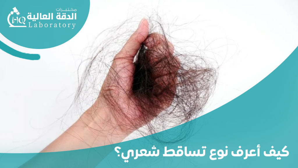 أسباب تساقط شعر الرأس عند النساء